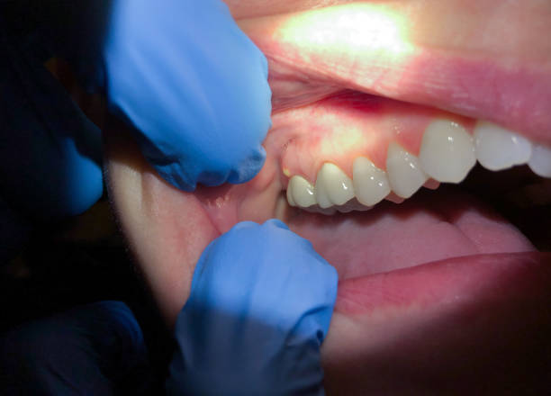 North Belle Vernon, PA Emergency Dentist Pros